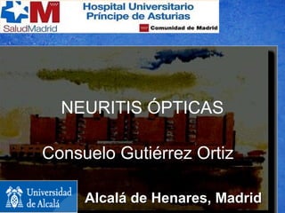 Consuelo Gutiérrez Ortiz
Hospital Príncipe de Asturias
Madrid
NEURITIS ÓPTICAS
Consuelo Gutiérrez Ortiz
Alcalá de Henares, MadridAlcalá de Henares, Madrid
 