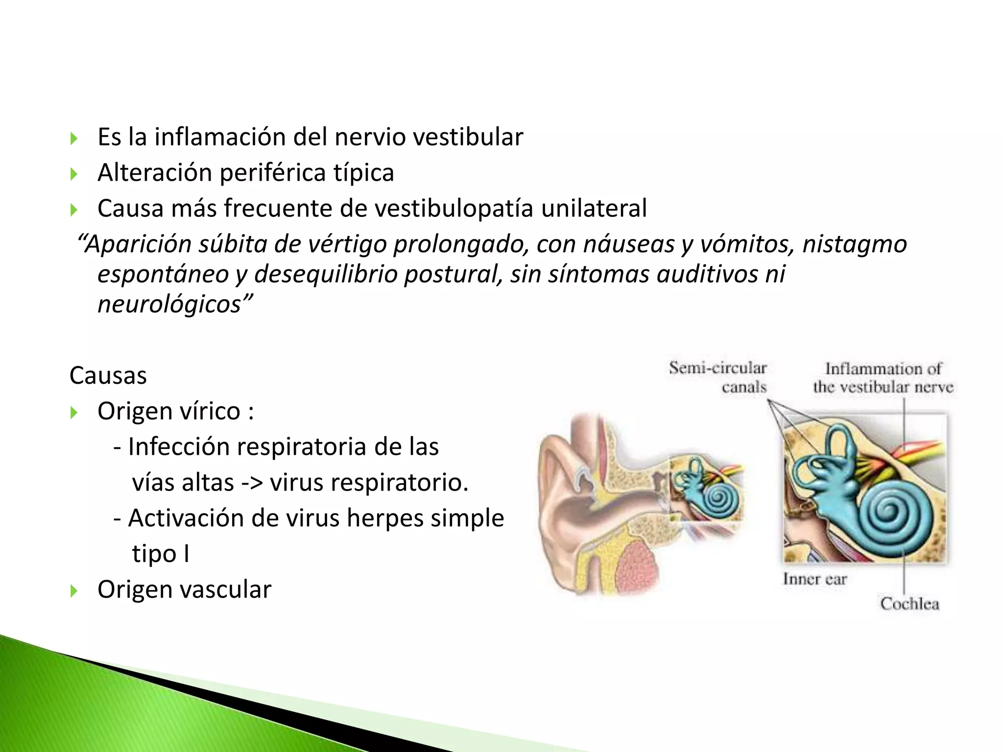Neuronitis Neuritis vestibular, una patología que afecta al nervio vestibular. | PPT