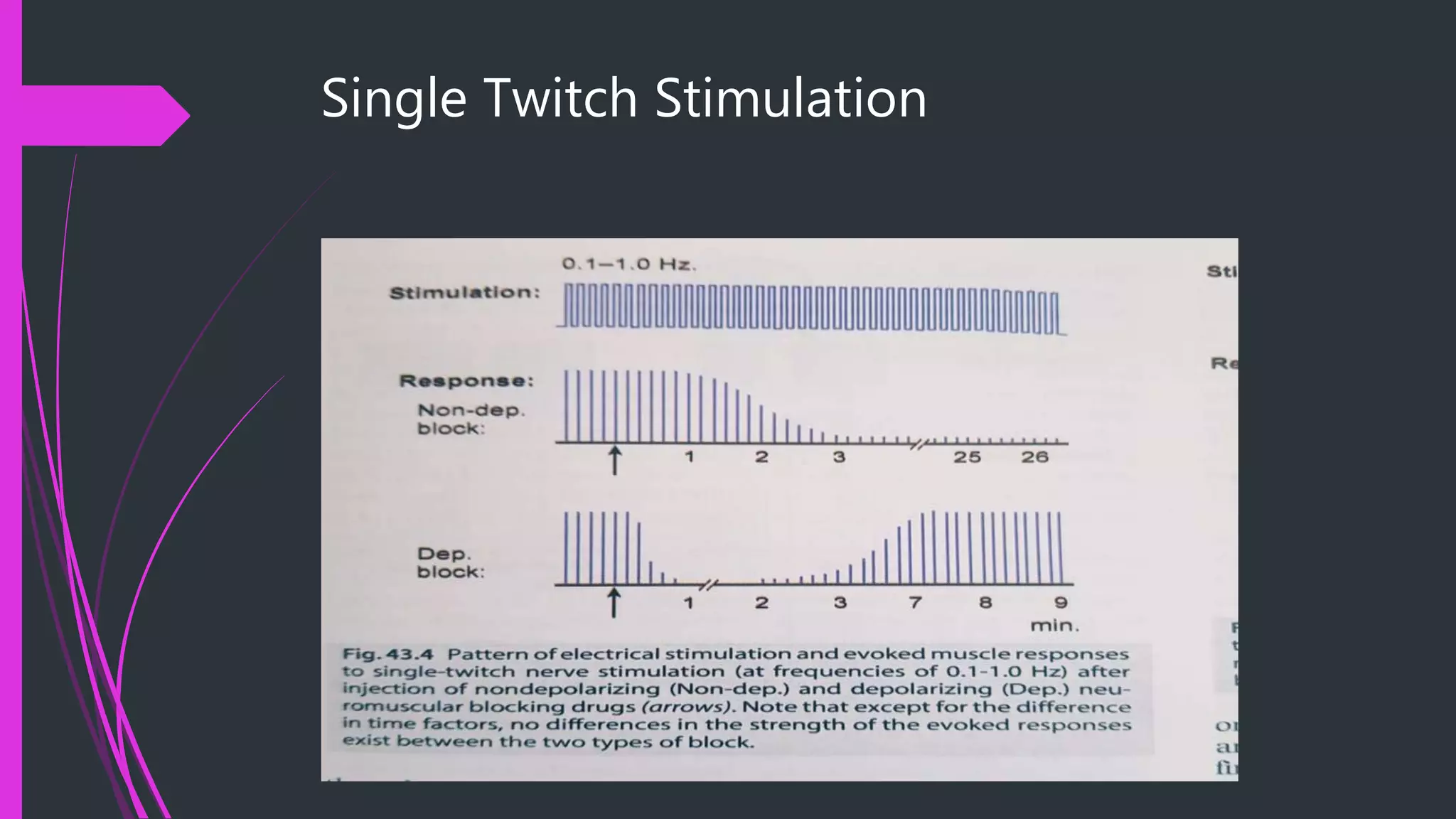 Single Twitch Stimulation
 