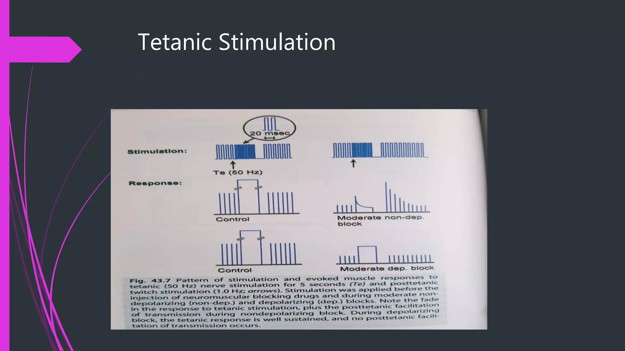 Tetanic Stimulation
 