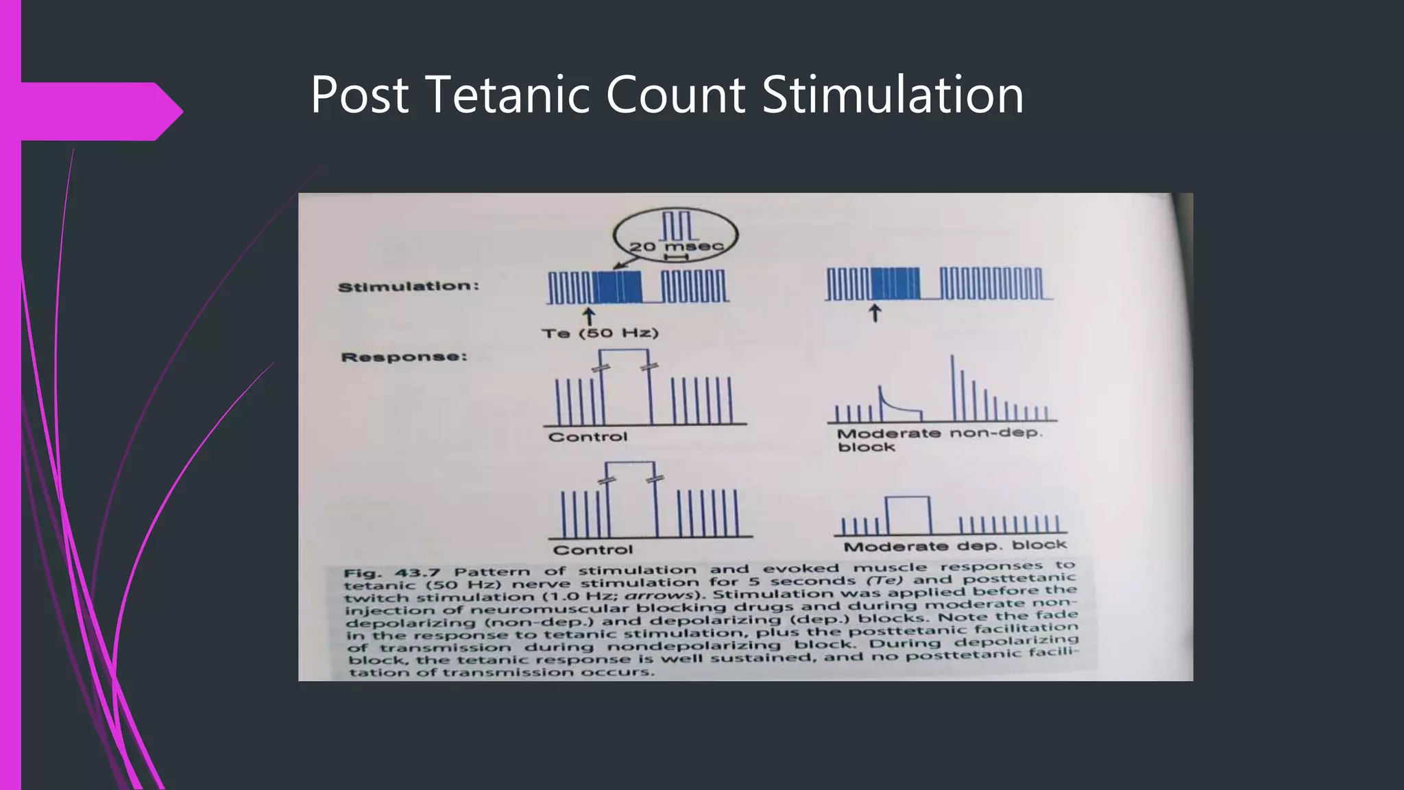 Post Tetanic Count Stimulation
 