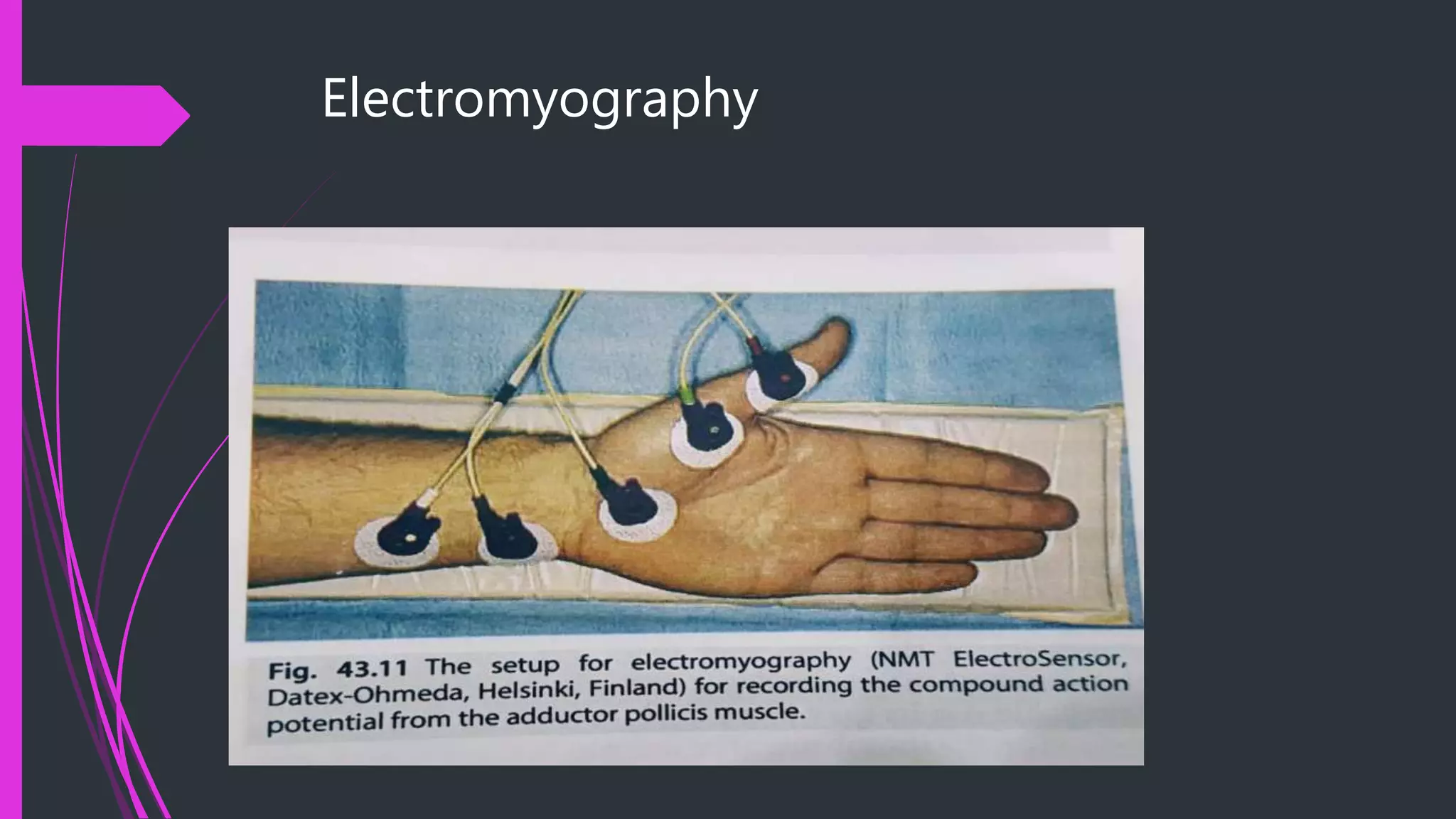 Electromyography
 