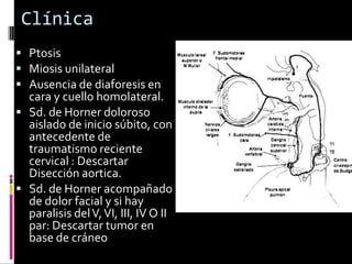 Clínica
 Ptosis
 Miosis unilateral
 Ausencia de diaforesis en
  cara y cuello homolateral.
 Sd. de Horner doloroso
  aislado de inicio súbito, con
  antecedente de
  traumatismo reciente
  cervical : Descartar
  Disección aortica.
 Sd. de Horner acompañado
  de dolor facial y si hay
  paralisis del V, VI, III, IV O II
  par: Descartar tumor en
  base de cráneo
 