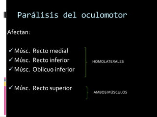 Parálisis del oculomotor
Afectan:

 Músc. Recto medial
 Músc. Recto inferior     HOMOLATERALES

 Músc. Oblicuo inferior


 Músc. Recto superior
                           AMBOS MÚSCULOS
 