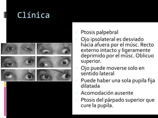 Clínica
           Ptosis palpebral
           Ojo ipsolateral es desviado
            hacia afuera por el músc. Recto
            externo intacto y ligeramente
            deprimido por el músc. Oblicuo
            superior.
           Ojo puede moverse solo en
            sentido lateral
           Puede haber una sola pupila fija
            dilatada
           Acomodación ausente
           Ptosis del párpado superior que
            cure la pupila.
 