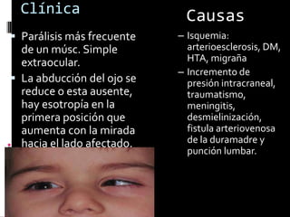 Clínica                    Causas
 Parálisis más frecuente   – Isquemia:
  de un músc. Simple          arterioesclerosis, DM,
  extraocular.                HTA, migraña
                            – Incremento de
 La abducción del ojo se     presión intracraneal,
  reduce o esta ausente,      traumatismo,
  hay esotropía en la         meningitis,
  primera posición que        desmielinización,
  aumenta con la mirada       fistula arteriovenosa
  hacia el lado afectado.     de la duramadre y
                              punción lumbar.
 