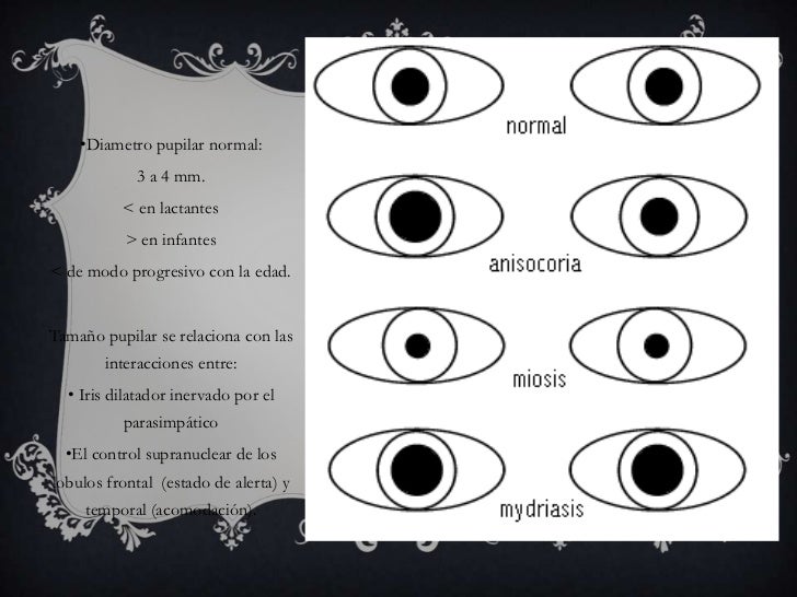 Neurooftalmología