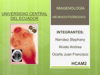 UNIVERSIDAD CENTRAL
DEL ECUADOR
INTEGRANTES:
Narváez Stephany
Nivelo Andrea
Ocaña Juan Francisco
HCAM2
NEUROCISTICERCOSIS
IMAGENOLOGÍA
 