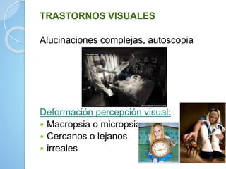 TRASTORNOS VISUALES
Alucinaciones complejas, autoscopia
Deformación percepción visual:
 Macropsia o micropsia
 Cercanos o lejanos
 irreales
 