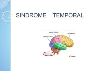 SINDROME TEMPORAL
 