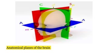 Anatomical planes of the brain
 