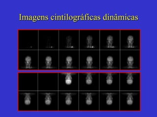 Imagens cintilográficas dinâmicas 