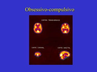 Obsessivo-compulsivo 