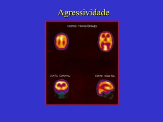 Agressividade 
