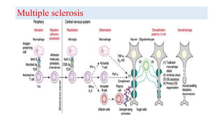 Multiple sclerosis
 
