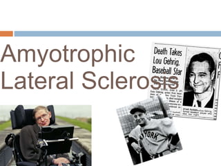 Amyotrophic
Lateral Sclerosis
 