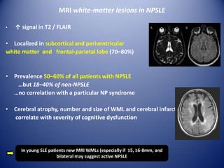 MRI white-matter lesions in NPSLE
•

↑ signal in Τ2 / FLAIR

• Localized in subcortical and periventricular
white matter and frontal-parietal lobe (70–80%)

• Prevalence 50–60% of all patients with NPSLE
…but 18–40% of non-NPSLE
…no correlation with a particular NP syndrome
• Cerebral atrophy, number and size of WML and cerebral infarcts
correlate with severity of cognitive dysfunction

In young SLE patients new MRI WMLs (especially if ≥5, ≥6-8mm, and
bilateral may suggest active NPSLE

 