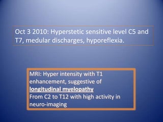 Oct 3 2010: Hyperstetic sensitive level C5 and
T7, medular discharges, hyporeflexia.

MRI: Hyper intensity with T1
enhancement, suggestive of
longitudinal myelopathy
From C2 to T12 with high activity in
neuro-imaging

 