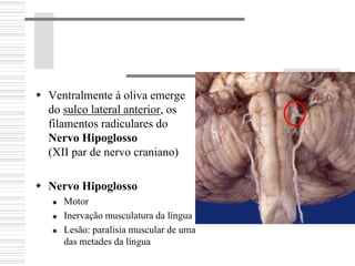 Ventralmente à oliva emerge
do sulco lateral anterior, os
filamentos radiculares do
Nervo Hipoglosso
(XII par de nervo craniano)
Nervo Hipoglosso
Motor
Inervação musculatura da língua
Lesão: paralisia muscular de uma
das metades da língua
 