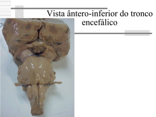 Vista ântero-inferior do tronco
encefálico
 