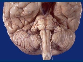 Anatomia Sistema Central