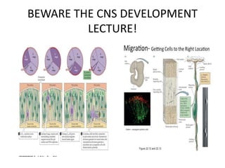 BEWARE THE CNS DEVELOPMENT
LECTURE!
 