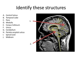 Identify these structures
A. Central Sulcus
B. Temporal Lobe
C. Pons
D. Medulla
E. Corpus Callosum
F. Uncus
G. Cerebellum
H. Parieto-occpital sulcus
I. Spinal Cord
J. Midbrain
1.
2.
 