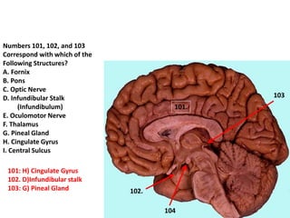 102.
103
104
101.
Numbers 101, 102, and 103
Correspond with which of the
Following Structures?
A. Fornix
B. Pons
C. Optic Nerve
D. Infundibular Stalk
(Infundibulum)
E. Oculomotor Nerve
F. Thalamus
G. Pineal Gland
H. Cingulate Gyrus
I. Central Sulcus
101: H) Cingulate Gyrus
102. D)Infundibular stalk
103: G) Pineal Gland
 