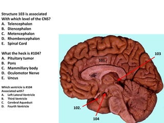 102.
103
104
101.
Structure 103 is associated
With which level of the CNS?
A. Telencephalon
B. Diencephalon
C. Metencephalon
D. Rhombencephalon
E. Spinal Cord
What the heck is #104?
A. Pituitary tumor
B. Pons
C. Mammillary body
D. Oculomotor Nerve
E. Uncus
Which ventricle is #104
Associated with?
A. Left Lateral Ventricle
B. Third Ventricle
C. Cerebral Aqueduct
D. Fourth Ventricle
 