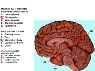Structure 103 is associated
With which level of the CNS?
A. Telencephalon
B. Diencephalon
C. Metencephalon
D. Rhombencephalon
E. Spinal Cord
What the heck is #104?
A. Pituitary tumor
B. Pons
C. Mammillary body
D. Oculomotor Nerve
E. Uncus
Which ventricle is #104
Associated with?
A. Left Lateral Ventricle
B. Third Ventricle
C. Cerebral Aqueduct
D. Fourth Ventricle 102.
103
104
101.
 