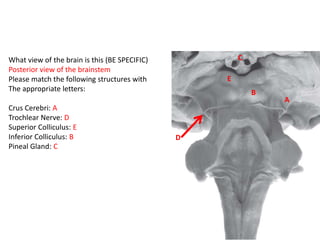 What view of the brain is this (BE SPECIFIC)
Posterior view of the brainstem
Please match the following structures with
The appropriate letters:
Crus Cerebri: A
Trochlear Nerve: D
Superior Colliculus: E
Inferior Colliculus: B
Pineal Gland: C
C
B
E
A
D
 