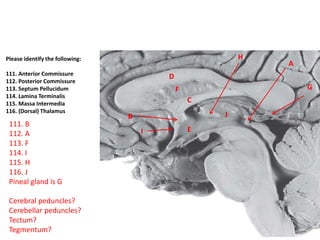 C
F
D
B
G
A
H
EI
J
Please identify the following:
111. Anterior Commissure
112. Posterior Commissure
113. Septum Pellucidum
114. Lamina Terminalis
115. Massa Intermedia
116. (Dorsal) Thalamus
111. B
112. A
113. F
114. I
115. H
116. J
Pineal gland is G
Cerebral peduncles?
Cerebellar peduncles?
Tectum?
Tegmentum?
 