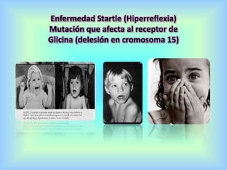 Enfermedad Startle (Hiperreflexia)
Mutación que afecta al receptor de
Glicina (delesión en cromosoma 15)
 