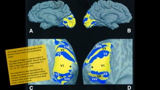 The image shows the topography of the
primary visual cortex and surrounding
areas.
This type of image is a typical output of
the brain shown in sagittal view (A and B)
with a close-up on the visual areas (V1,
V2, V3, VP, V3A and V4V) .
It is important to note that there is no
single area where all specialised visual
circuitry connects and therefore no single
neural centre exists and it is more likely
to be a neural network.
 