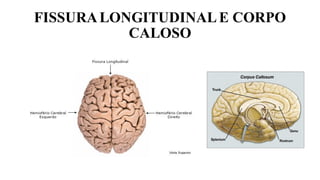 FISSURALONGITUDINALE CORPO
CALOSO
 