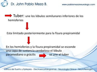 Tuber: une los lóbulos semilunares inferiores de los                           hemisferiosEsta limitado posteriormente para la fisura prepiramidalEn los hemisferios y la fisura prepiramidal se esconde una capa de sustancia cerebelosa el lóbulo paramediano o grácilis          se une al tuber