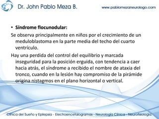 Síndrome flocunodular:Se observa principalmente en niños por el crecimiento de un meduloblastoma en la parte media del techo del cuarto ventrículo.Hay una perdida del control del equilibrio y marcada inseguridad para la posición erguida, con tendencia a caer hacia atrás, el síndrome a recibido el nombre de ataxia del tronco, cuando en la lesión hay compromiso de la pirámide origina nistagmos en el plano horizontal o vertical. 