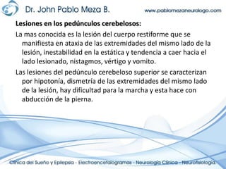 Retardo en la iniciación y finalización de los movimientos intencionales