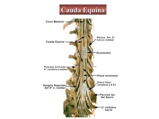 Cauda Equina
 