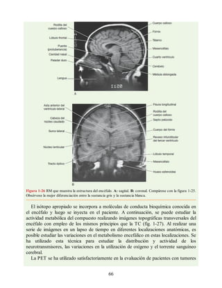 Figura 1-26 RM que muestra la estructura del encéfalo. A: sagital. B: coronal. Compárese con la figura 1-25.
Obsérvese la mejor diferenciación entre la sustancia gris y la sustancia blanca.
El isótopo apropiado se incorpora a moléculas de conducta bioquímica conocida en
el encéfalo y luego se inyecta en el paciente. A continuación, se puede estudiar la
actividad metabólica del compuesto realizando imágenes topográficas transversales del
encéfalo con empleo de los mismos principios que la TC (fig. 1-27). Al realizar una
serie de imágenes en un lapso de tiempo en diferentes localizaciones anatómicas, es
posible estudiar las variaciones en el metabolismo encefálico en estas localizaciones. Se
ha utilizado esta técnica para estudiar la distribución y actividad de los
neurotransmisores, las variaciones en la utilización de oxígeno y el torrente sanguíneo
cerebral.
La PET se ha utilizado satisfactoriamente en la evaluación de pacientes con tumores
66
ERRNVPHGLFRVRUJ
ERRNVPHGLFRVRUJ
 