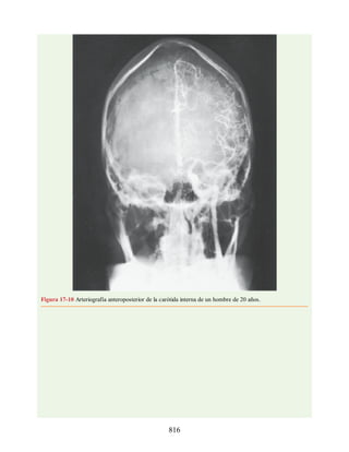 Neuroanatomia_Clinica_Snell_7a_Edicion_b.pdf
