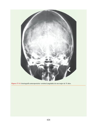 Neuroanatomia_Clinica_Snell_7a_Edicion_b.pdf
