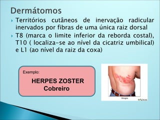  Territórios cutâneos de inervação radicular
inervados por fibras de uma única raiz dorsal
 T8 (marca o limite inferior da reborda costal),
T10 ( localiza-se ao nível da cicatriz umbilical)
e L1 (ao nível da raiz da coxa)
HERPES ZOSTER
Cobreiro
Exemplo:
 