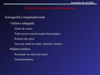 Acidente Vascular Cerebral Isquêmico Tomografia Computadorizada Infarto subaguda Efeito de massa Pode ocorrer transformação hemorrágica Reforço dos giros Área em cunha na subst. cinzenta e branca Infarto crônico Resolução do efeito de massa Encefalomalacia Anatomia do encéfalo 