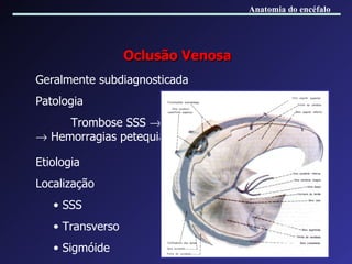 Geralmente subdiagnosticada Patologia Trombose SSS    Oclusão de tributárias corticais    Hemorragias petequiais perivasculares Oclusão Venosa Etiologia Localização SSS Transverso Sigmóide Anatomia do encéfalo 