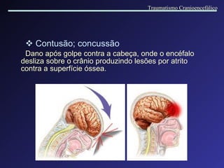 Contusão; concussão Dano após golpe contra a cabeça, onde o encéfalo desliza sobre o crânio produzindo lesões por atrito contra a superfície óssea. Traumatismo Cranioencefálico 