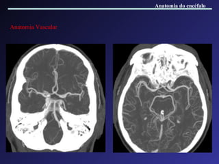 Anatomia Vascular Anatomia do encéfalo 
