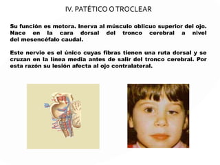 III. Par craneal: motor ocular común
Es un nervio motor encargado de los movimientos de la
musculatura del ojo. Inerva a todos los músculos.
Las fibras de este par
se originan en dos
núcleos:
Núcleo somatomotor,
situado en los
pedúnculos
cerebrales.
Núcleo parasimpático
motor.
 