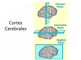 CORTE CORONAL O FRONTAL
De arriba abajo y de oreja a oreja
Es el corte que se realiza a través de la línea longitudinal media que
pasa por las orejas. Su nombre se debe al cruce que hace por la sutura
coronal (frontal con los dos parietales). Sus cortes se observan desde
atrás.
LATERALMEDIAL
 