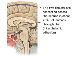 • The t wo t halami are
connect ed acr oss
t he midline in about
70% of humans
t hrough t he
(int ert halamic
adhesion)
 
